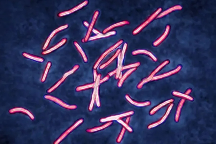  वैज्ञानिकहरूलाई बुझ्न १० वर्ष लागेको समस्या एआईद्वारा २ दिनमै समाधान