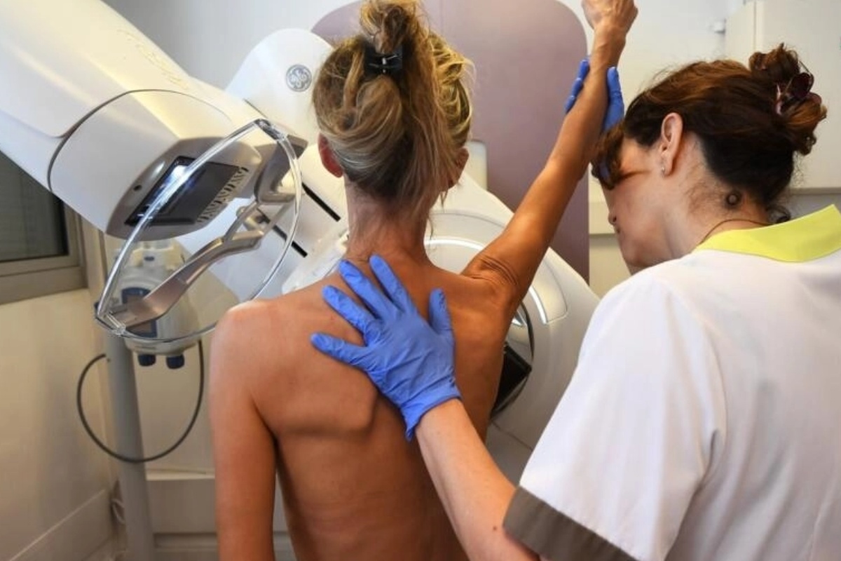 अमेरिकामा सबै महिलालाई ४० वर्षपछि स्तन क्यान्सर परीक्षण गर्न सुझाव