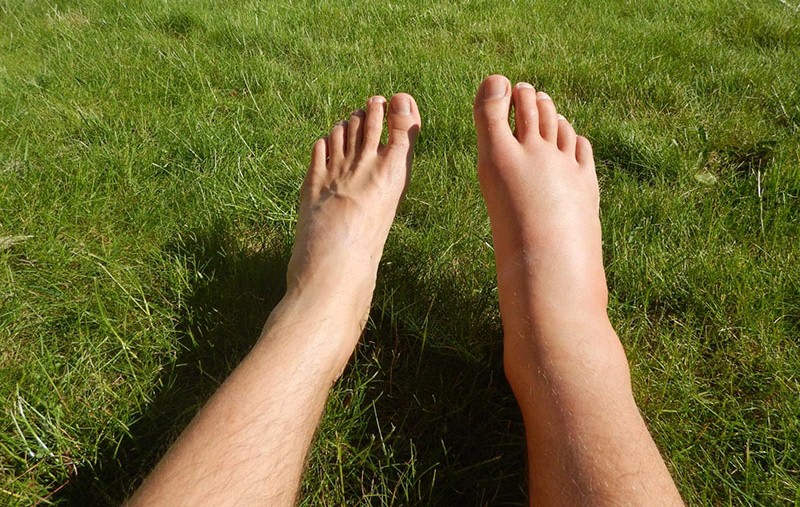 बाँकेका ३ स्थानीय तहमा अझै हात्तीपाइलेको जोखिम