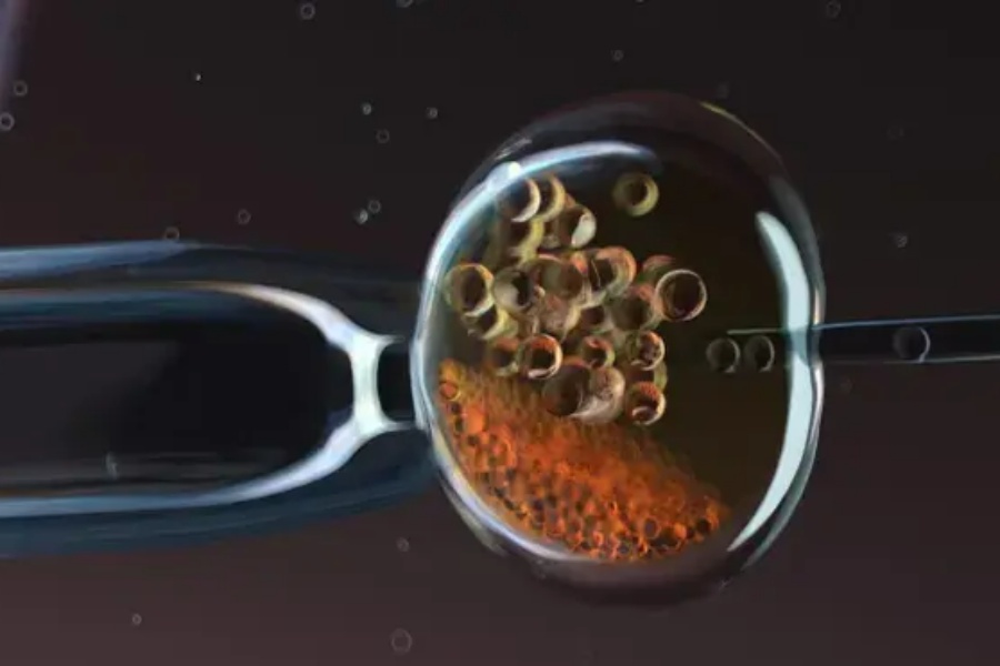 विश्वका प्रत्येक ६ मध्ये १ जनामा बाँझोपन : डब्लुएचओ