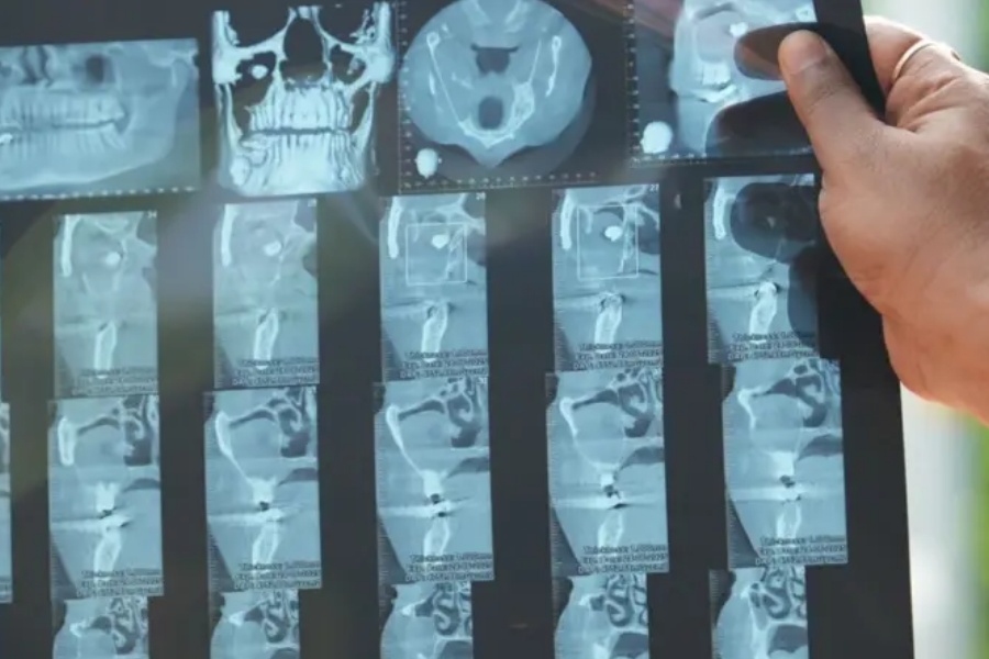 आँखामा दाँत पलाएपछि