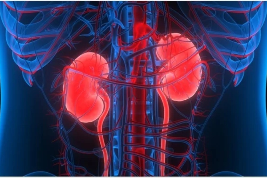 ‘मलेसिया र खाडी मुलुकमा कार्यरत नेपालीमा मिर्गौलाको समस्या धेरै’