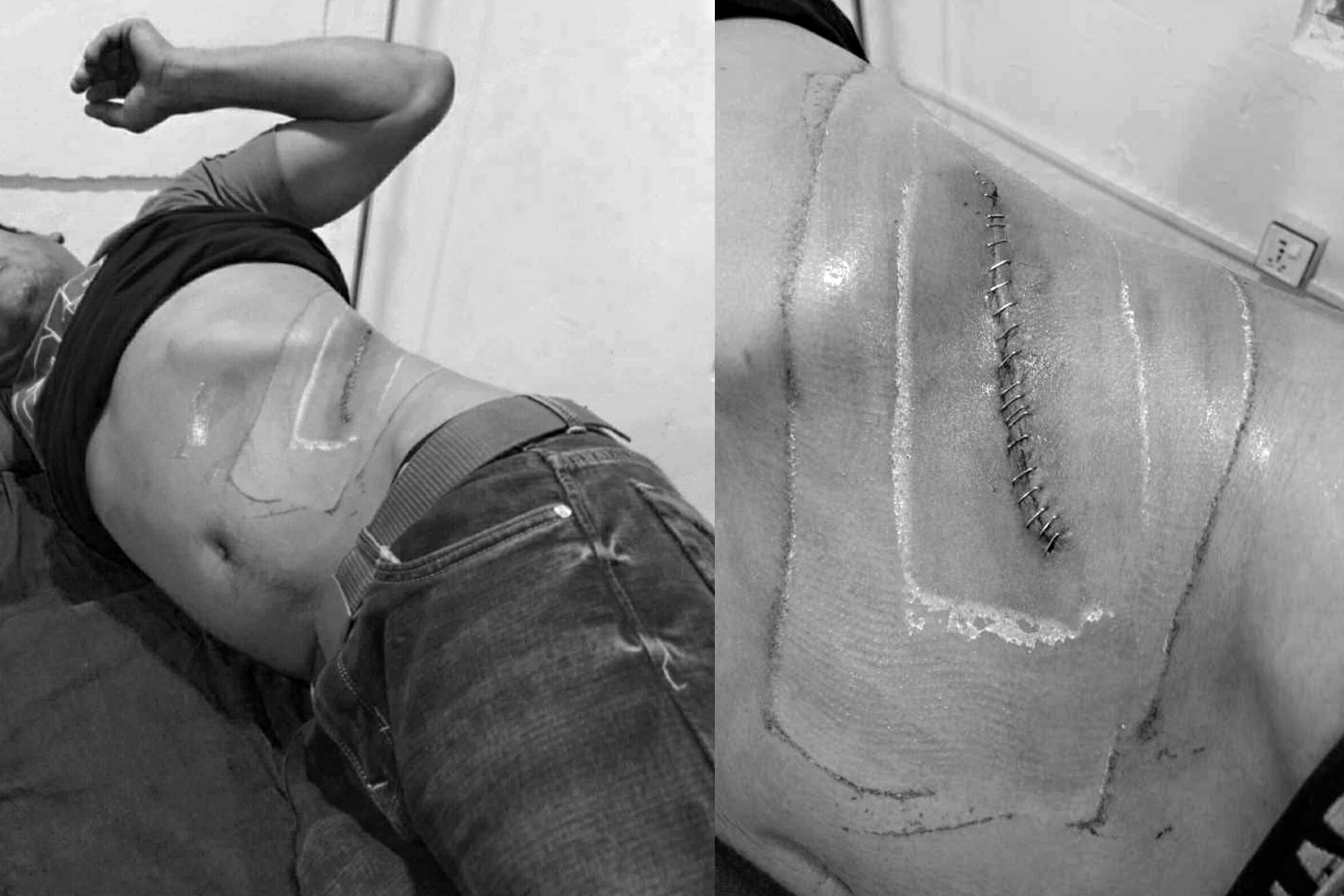 भारत पुर्‍याएर मिर्गौला झिकियो, नेपाल आउँदासम्म थाहा पाएनन्